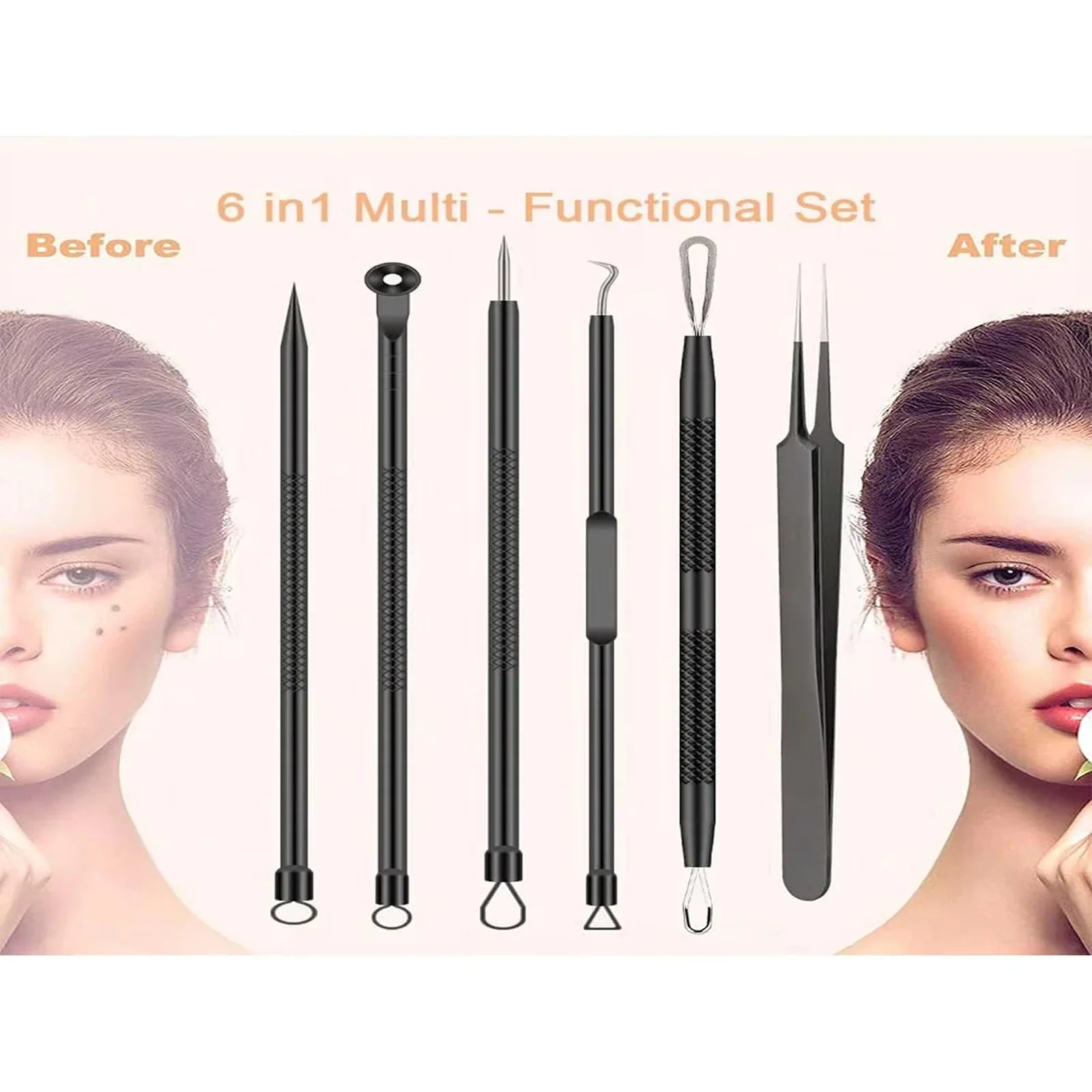 Acne Removal Needle Set for Skincare-4
