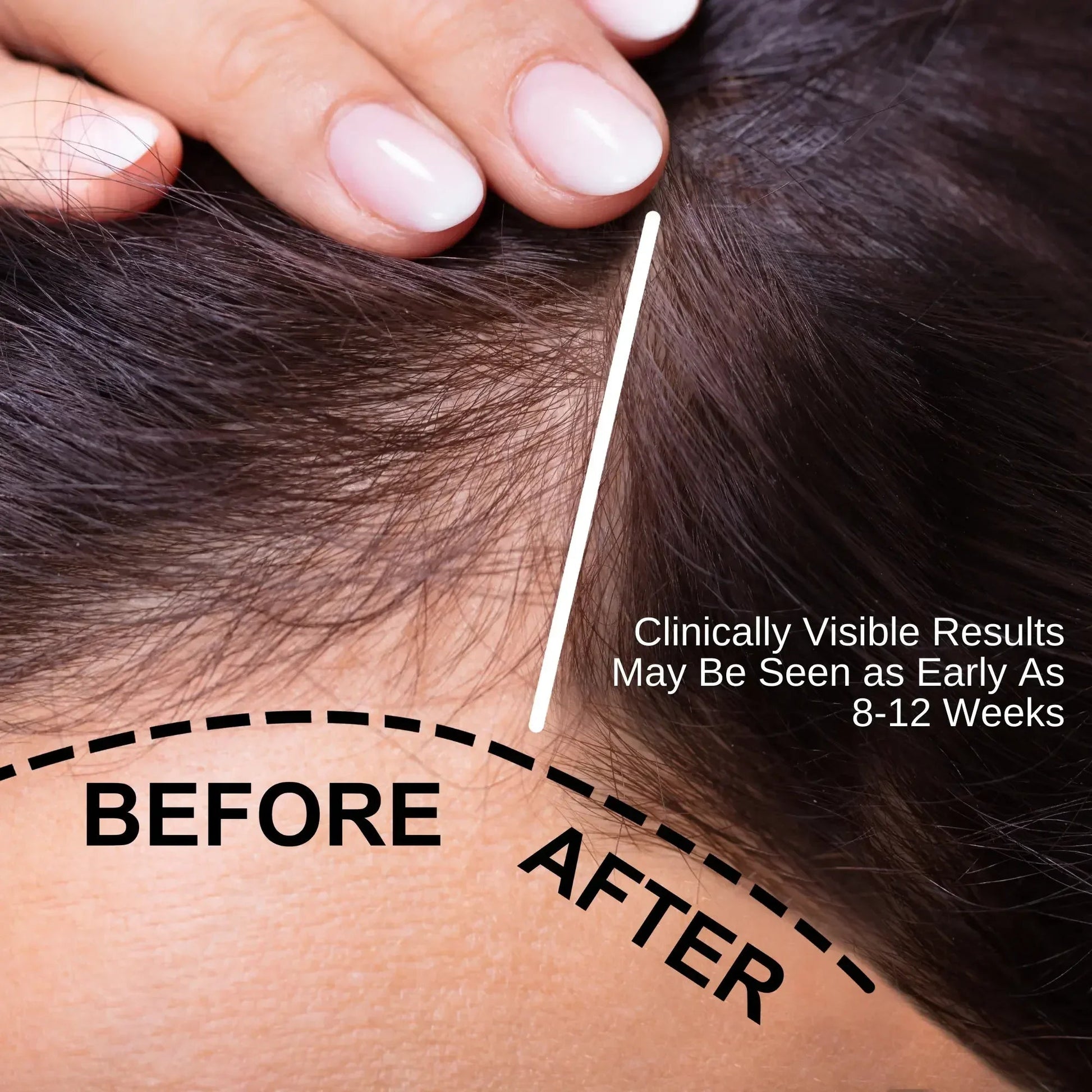 Ammuri Natural Hair Oil – Nourishing Scalp & Hair Care for Thicker-Looking Hair (50ml)-2